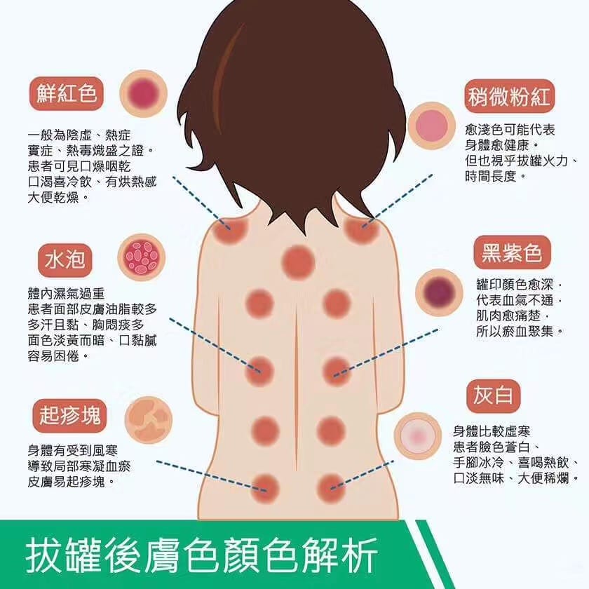 士嘉堡私做AA 中医养生专业推拿 真波盆大又挺